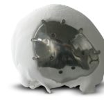 Cranio-Oss – Precise customized geometry
