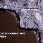 Osteoconductive PEEK