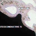 Osteoconductive titanium